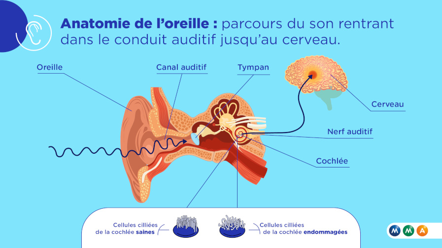 Infog_Oreille-audition_897x505.jpg (MMA_INFOG_Zeroblabla_V1)